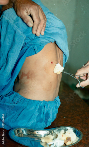 doctor treating a wounded child