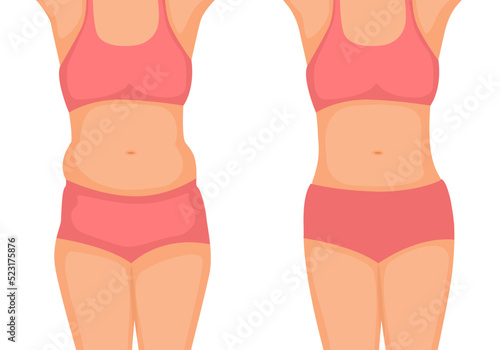 young woman body Before and After weight loss showing from fat to slim belly fat concept