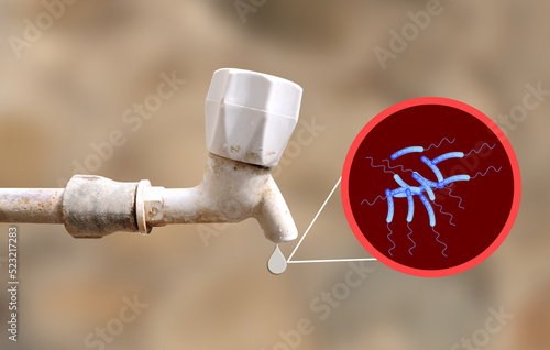 Tableau sur toile CHOLERA BECTERIA and tap showing main reason for cholera is water