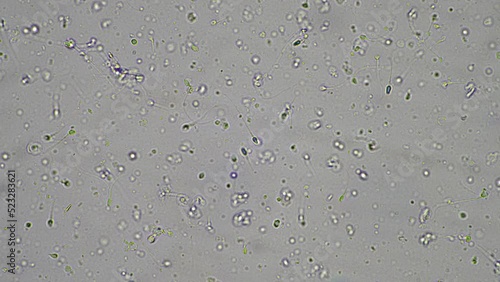 Sperm under the microscope. Looking a semen swimming. Healthy fertile man high sperm count