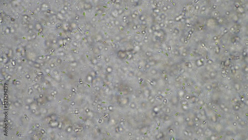 Sperm under the microscope. Looking a semen swimming. Healthy fertile man high sperm count