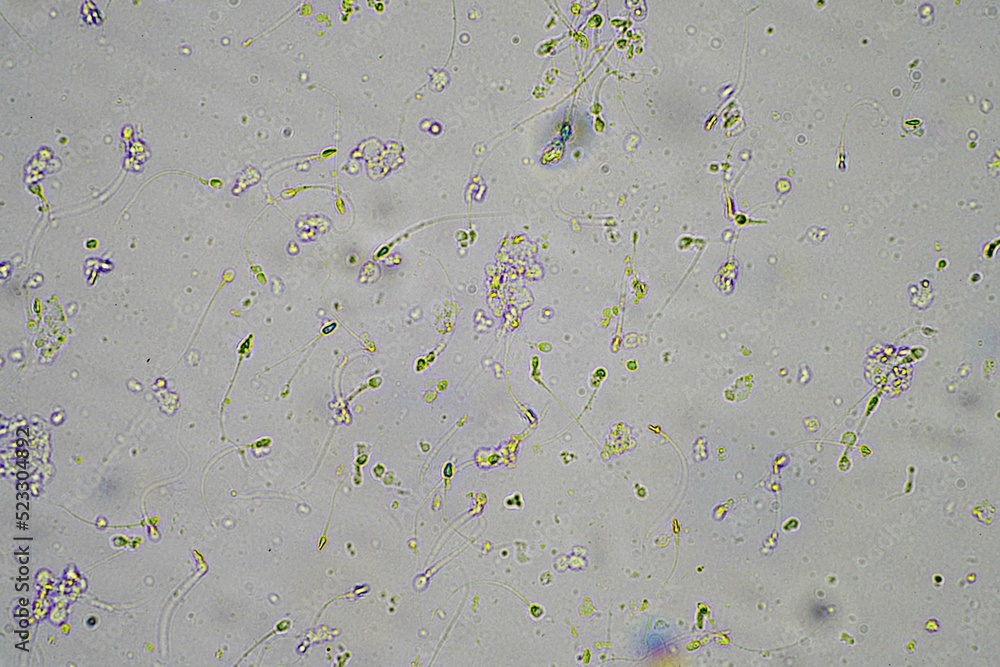 person with a virus coughing, Phlegm and mucus under the microscope ...