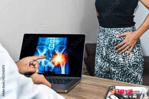 Doctor showing a x-ray of pain in the hips on a laptop. Woman patient in the background