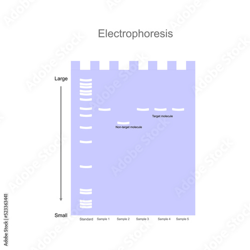 The interpretation result of target DNA detection by Gel Electrophoresis technique in unknown sample that comparing with standard marker