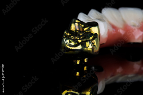 gilded teeth part of the prosthesis of the upper jaw on a black background with space for text