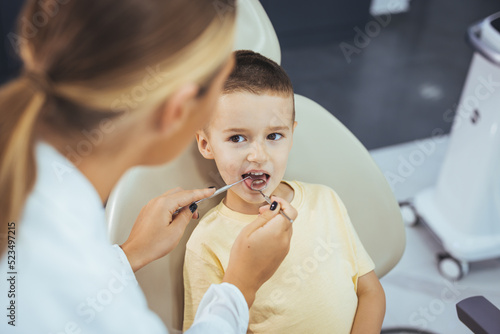 Beautiful boy at the dentist getting a check up on her teeth - pediatrics dental care concepts. Cute little boy getting teeth exam at dental clinic. Dental care, Medical care, Lifestyle