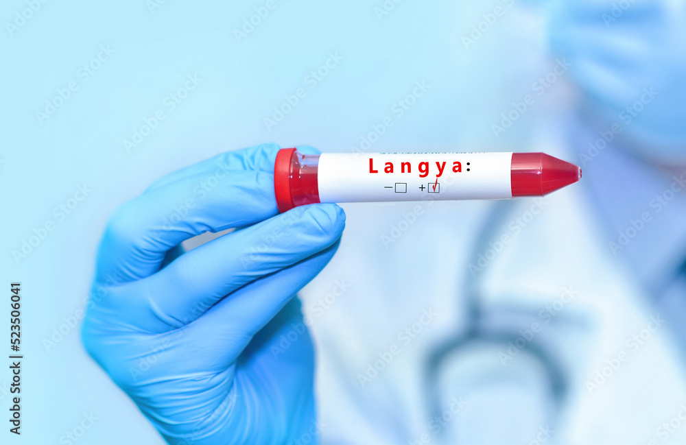 Doctor holding a test blood sample tube with positive Langya henipavirus (LayV).The virus is transmitted from animals to humans. Infected people suffer from fever, cough, headache, nausea and vomiting Doctor holding a test blood sample tube with positive Langya henipavirus (LayV).The virus is transmitted from animals to humans. Infected people suffer from fever, cough, headache, nausea and vomiting