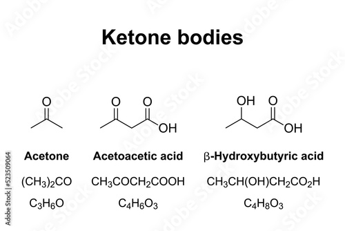 Ketone bodies, chemical formulas. Water-soluble molecules, that contain ketone groups, produced from fatty acids by the liver by ketogenesis. Acetone, Acetoacetic acid, and beta-Hydroxybutyric acid. photo