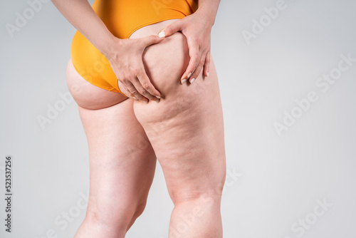 Overweight woman, fat thighs and buttocks, obesity female legs with cellulite