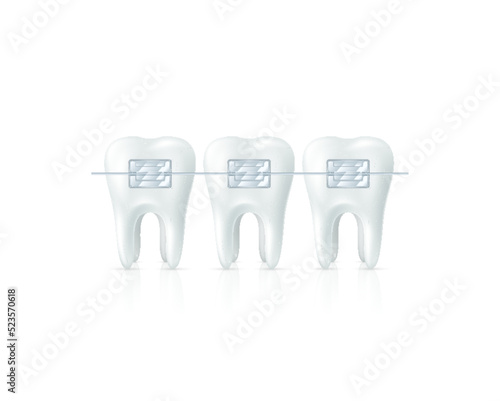 Metallic braces on teeth. Cure orthodontic dentistry medical set. Human tooth and aesthetic brackett