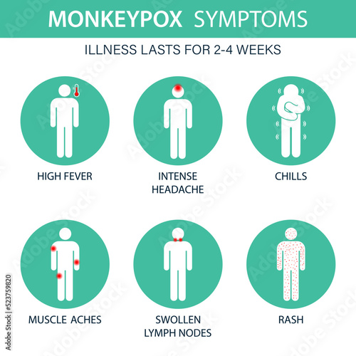 Symptoms of the monkey pox virus. Monkey pox is spreading. This causes skin infections. Infographic of symptoms of the monkey pox virus