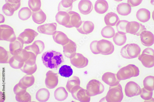 Picture of white blood cell, red blood cell and platelet in blood film, analyze by microscope, 1000x 