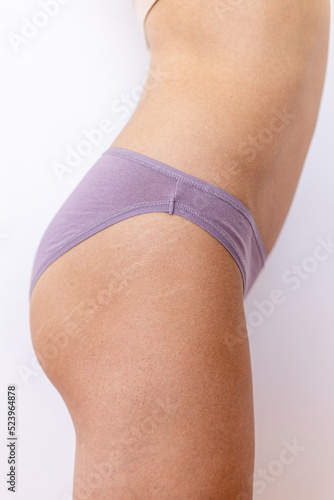 Female body with stretch marks on the buttocks