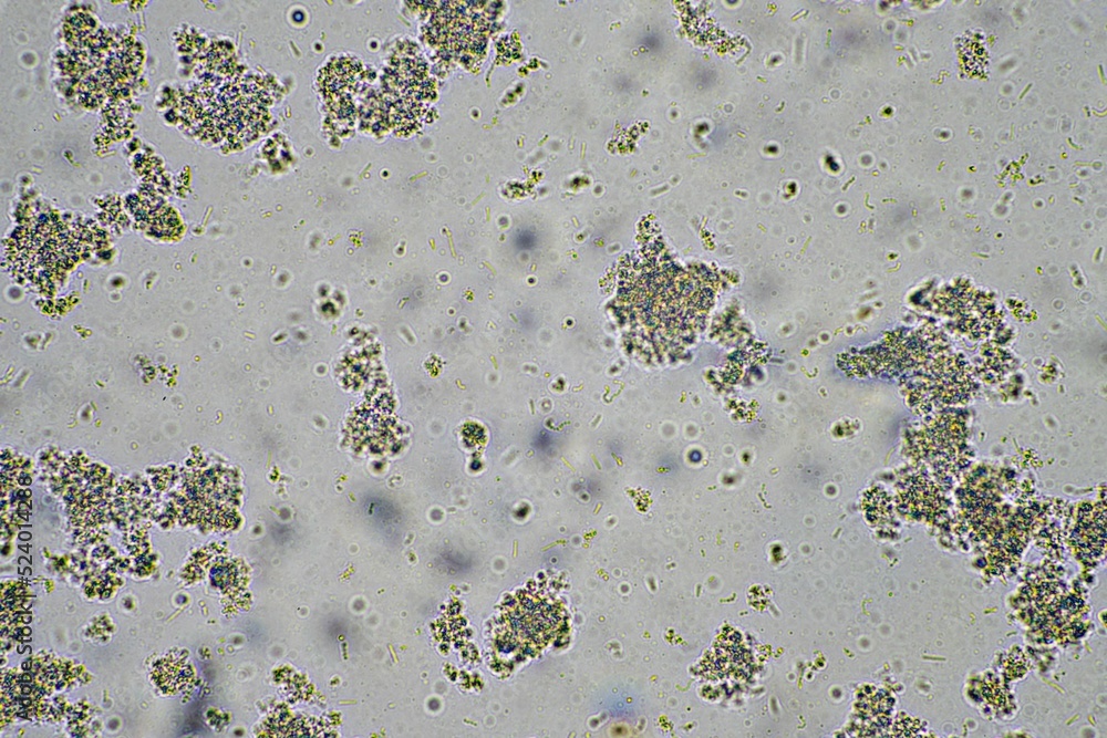 coughing, Phlegm and mucus under the microscope Stock-Foto | Adobe Stock