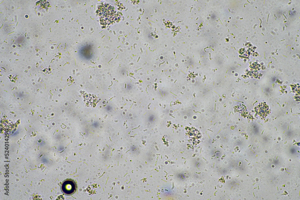 Yogurt Under The Microscope Looking At Lactobacillus Bacteria In A Healthy Gut Biome Foto De