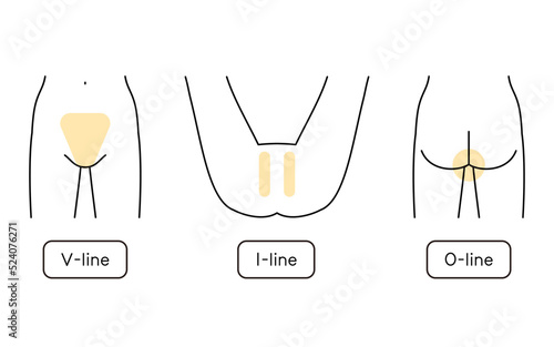 女性の脱毛イラスト　VIO