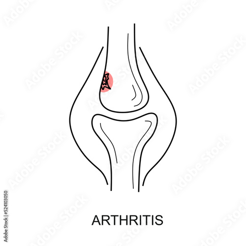 Joint pain icon. Bone, injury, disease. Arthritis concept. Can be used for topics like symptom, healthcare, anatomy