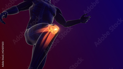Pain in the knee joint 