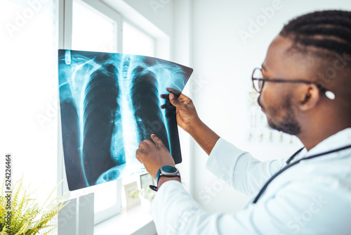Male radiologist analyzing chest X-ray of an patient at medical clinic during coronavirus epidemic. Doctor with radiological chest x-ray film for medical diagnosis on patient's health on asthma photo