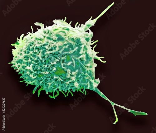 Mesenchymal stem cell, SEM photo
