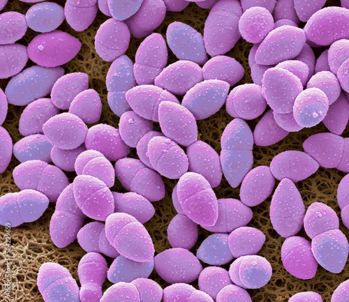 Kefir bacteria, SEM