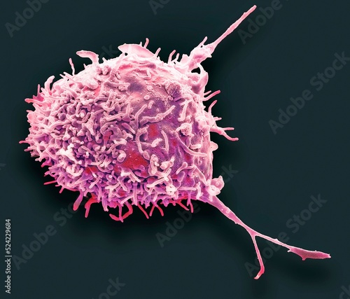 Mesenchymal stem cell, SEM photo