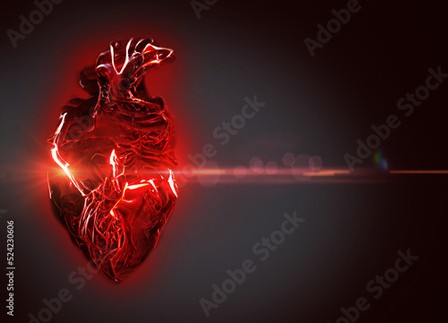 Heart attack, conceptual illustration photo