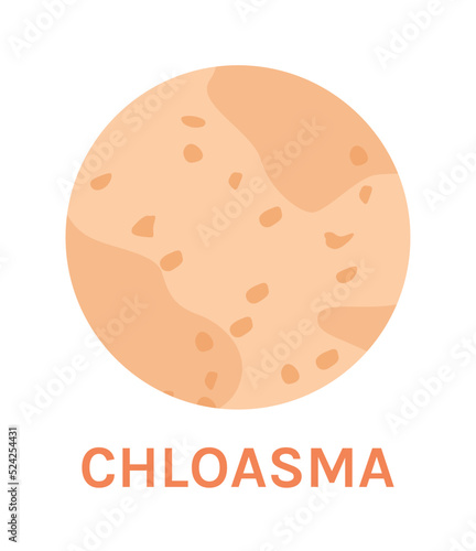 Chloasma. A Skin Problem and Disease. Pigmentation and Freckles on Human Skin. Melasma in Close up. Zoom. Circle Icon. Color Image. Vector illustration for Medical Design.