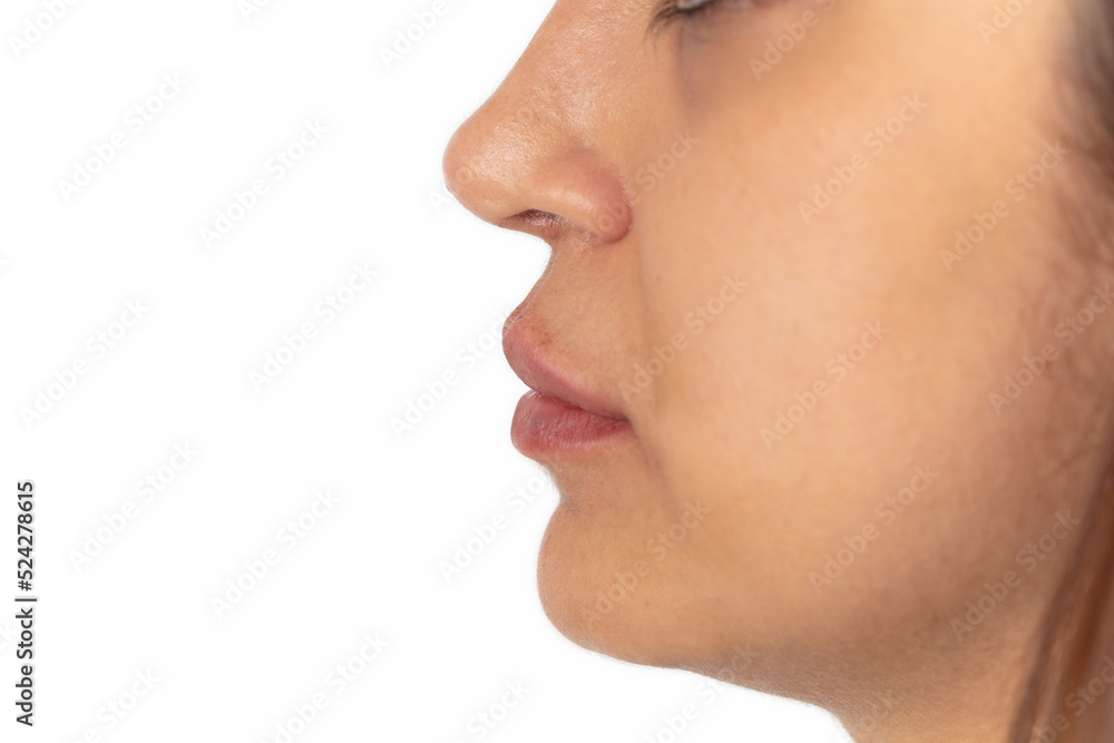 Close-up of female lips after augmentation.
Close-up of female lips after augmentation.