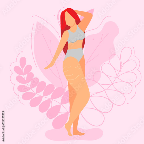 Vector illustration on the theme of body positivity. A girl with stretch marks on her thighs with long red hair on a background of beautiful leaves. Flat style