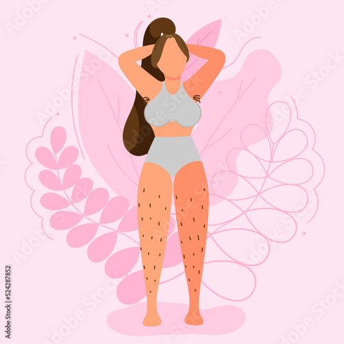 Vector illustration on the theme of body positivity. A girl who refused to shave her body, with hair on her legs and armpits against a background of beautiful leaves. Flat style