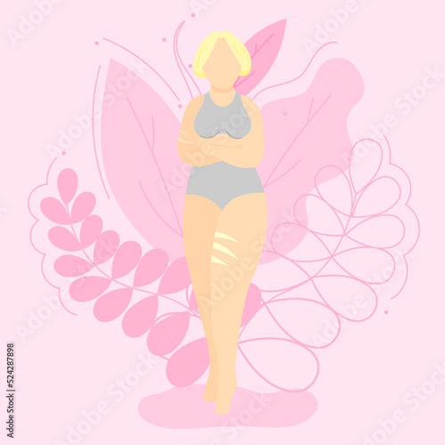 Vector illustration on the theme of body positivity. A girl with scars on her arm and leg with short blonde hair on a background of beautiful leaves. Flat style