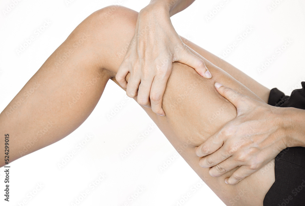 Close-up of Woman's hand holding and pushing legs with cellulitis fat. Close-up of Woman's hand holding and pushing legs with cellulitis fat.