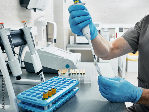 Scientist in gloves and with micropipette in his hands at medical laboratory. Laboratory technician determines blood group and Rh factor by gel agglutination using ID-Cards