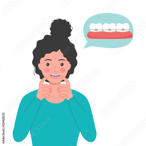 Woman with dental braces in flat design on white background. Orthodontic teeth concept vector illustration.