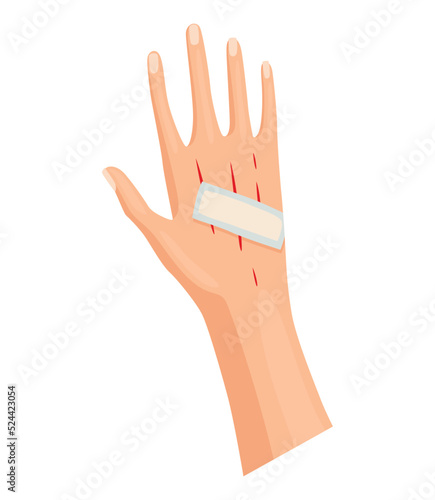 Hands injured skin and procedures of bandaging. First aid for wound. Medicine cure or treatment. First emergency help for human hand trauma