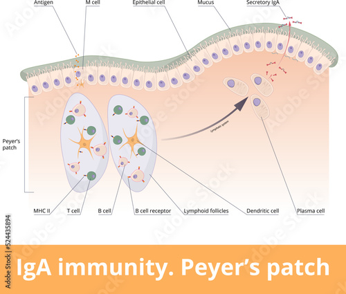 IgA immunity. Peyer’s patch. Lymphoid follicles of the small intestine generate IgA immune response with B cells, T cells, dendritic cells, and plasma cells secreting IgA.