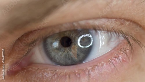 Closeup of blue male eye with contact lens looking at camera. Selective focus.