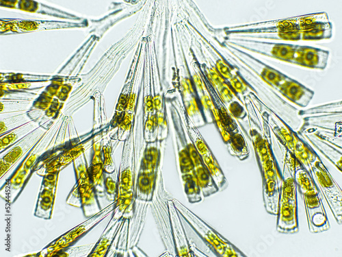 Licmophora sp. algae, marine and freshwater diatom under microscopic view. Genus of benthic, photosynthetic and epiphyte diatom photo