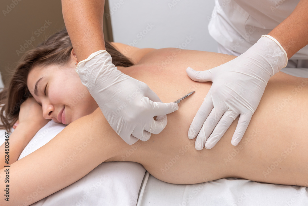 Fototapeta premium young woman lying on a stretcher in an aesthetic center performing beauty treatment and facial aesthetics with dermapen and dermaplaning techniques
