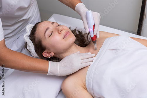 young woman lying on a stretcher in an aesthetic center performing beauty treatment and facial aesthetics with dermapen and dermaplaning techniques