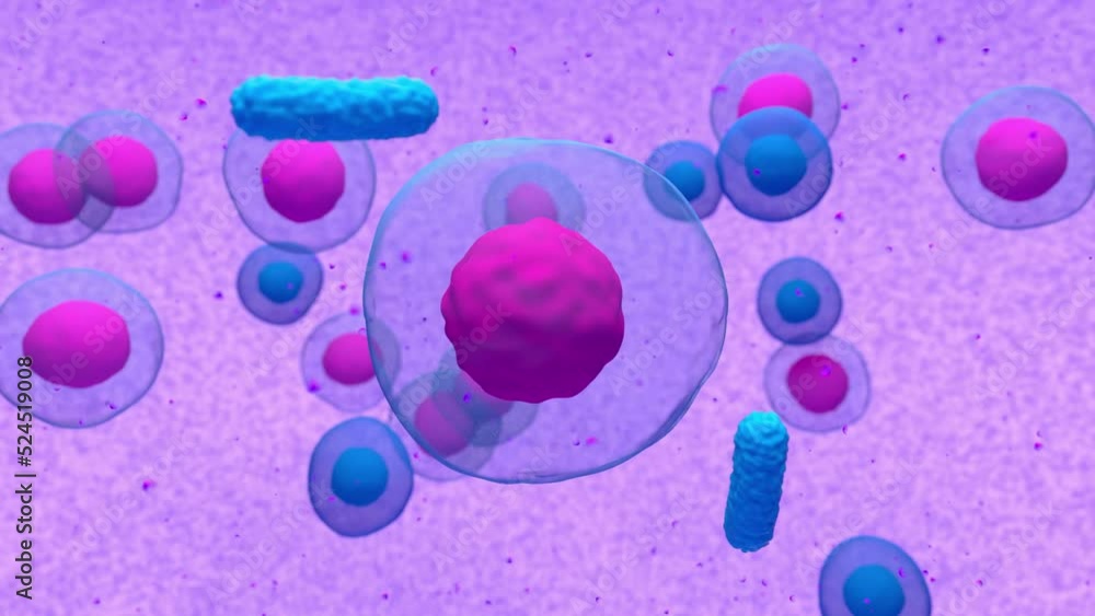 Abnormal plasma cell or bcell in multiple myeloma emitting paraprotein