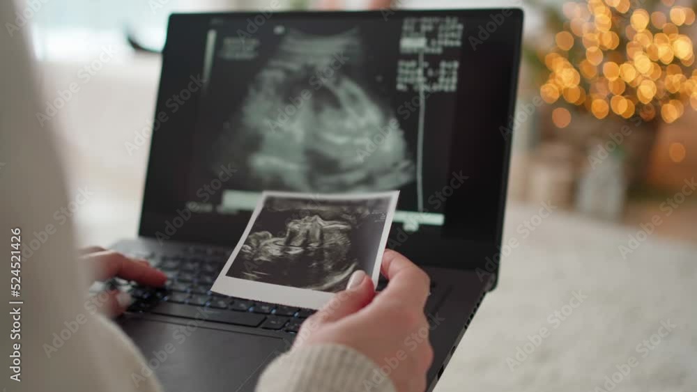 a pregnant woman watches a video of the ultrasound of the future baby