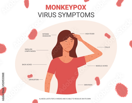 Banner with monkeypox virus symptoms. Concept of monkeypox virus Symptom infographics. A new zoonotic virus from Poxviridae family are reported in Europe and USA. Vector illustration.
