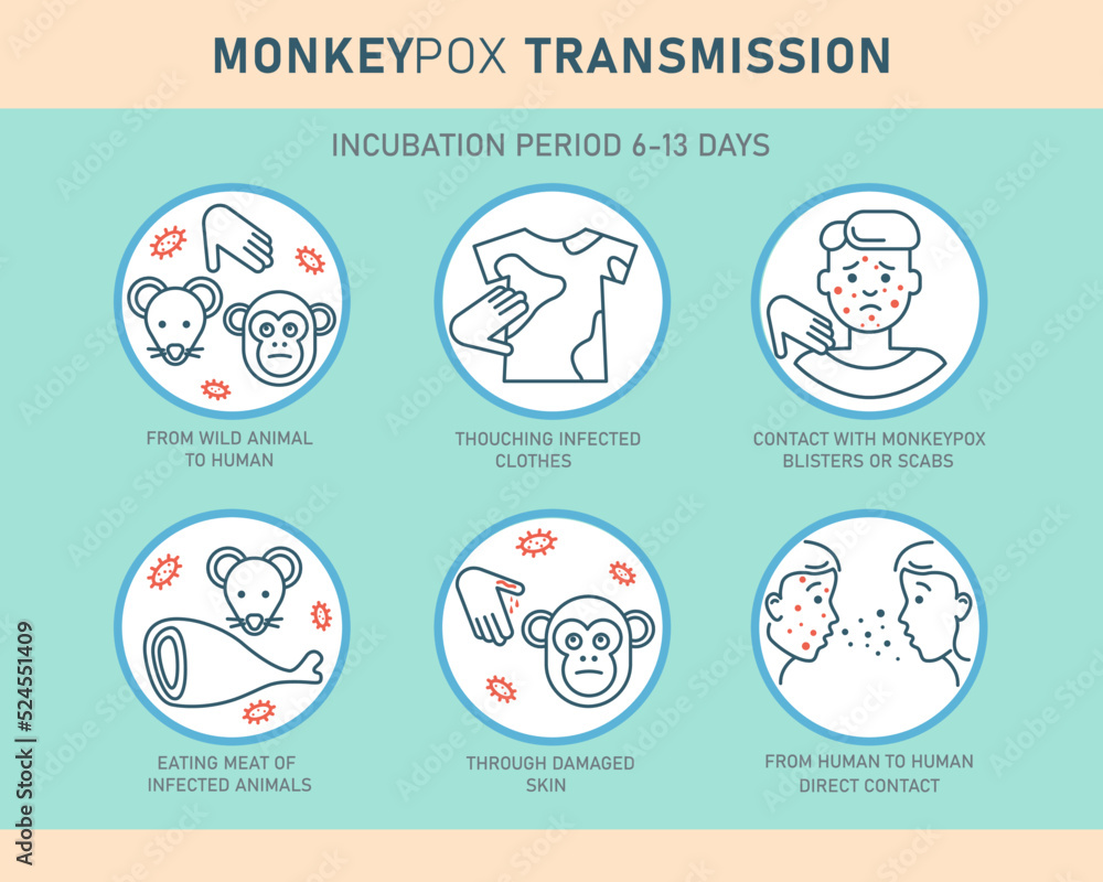 Monkeypox virus transmission infographics with icons isolated on white background. Vector flat illustration for medical concept. Design for banner, poster, flyer.