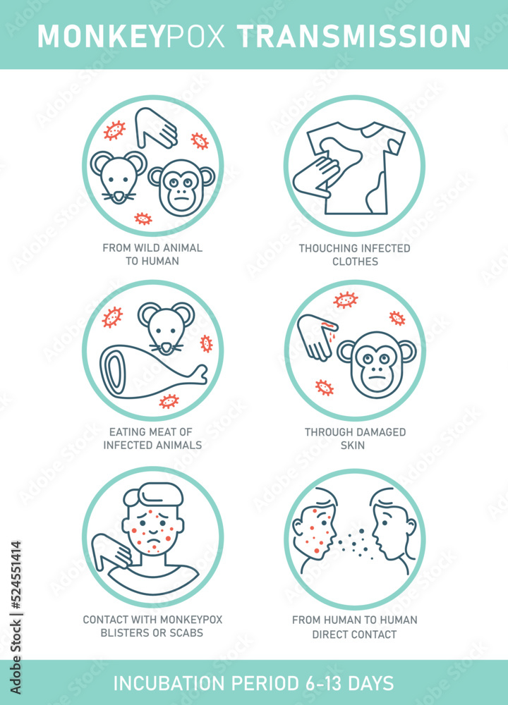 Monkeypox virus transmision infographics with icons isolated on white background. Vector flat illustration for medical concept. Design for banner, poster, flyer. Monkeypox virus transmision infographics with icons isolated on white background. Vector flat illustration for medical concept. Design for banner, poster, flyer.