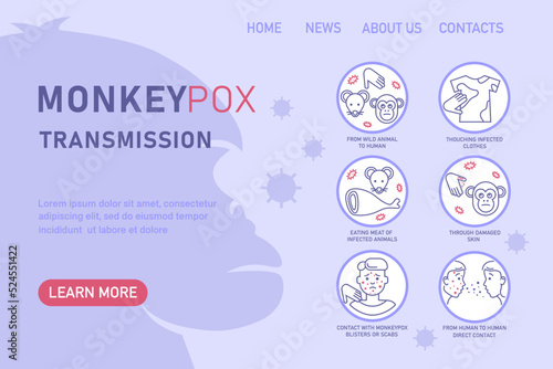 Monkeypox virus transmission infographics with icons. Vector flat illustration for medical concept. Design for banner, poster, flyer,  landing page, web
