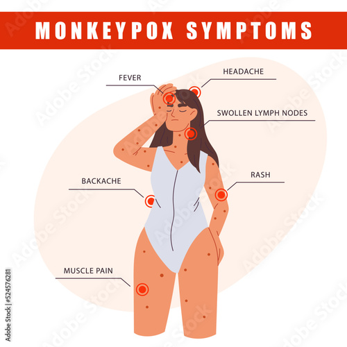 Monkeypox virus symptoms infographics. Woman with symptoms of Monkeypox. Fever, headache, rash. Information poster with symptoms of monkeypox virus. Woman suffering from the monkeypox virus