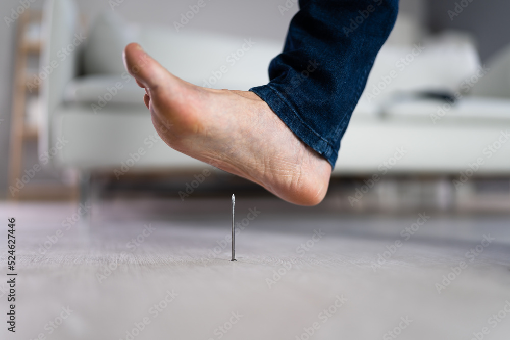 Foto de Foot Pin Accident. Tetanus Feet Ache do Stock Adobe Stock