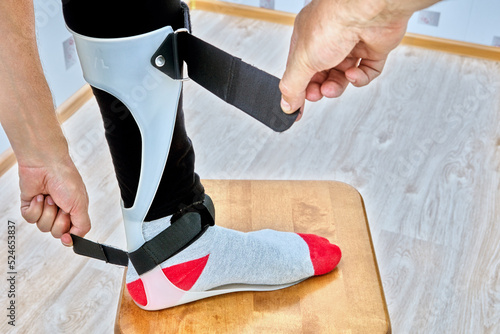 Quadro su tela Ankle foot orthosis brace is fixed on leg with velcro straps.